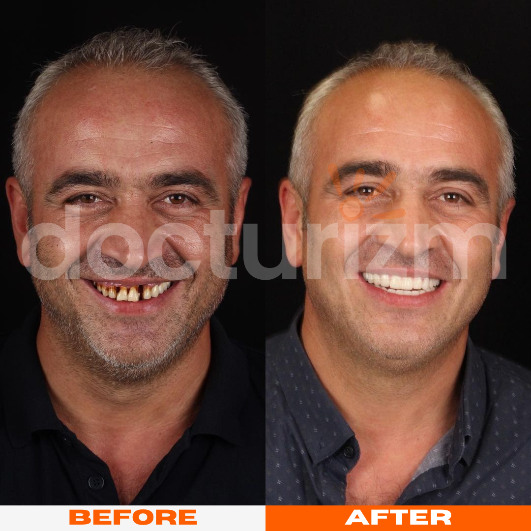 docturizm-beforeafter-2