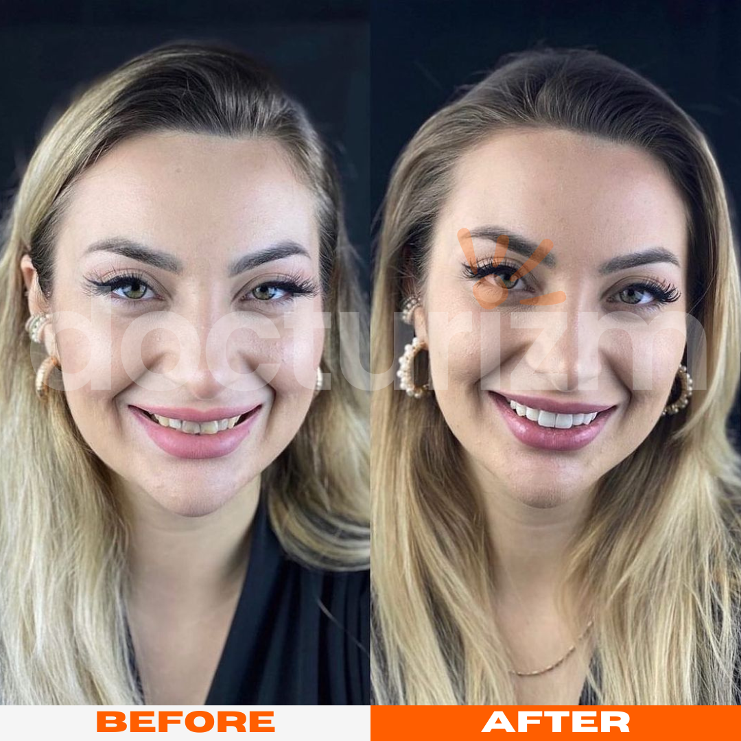 docturizm-beforeafter-3