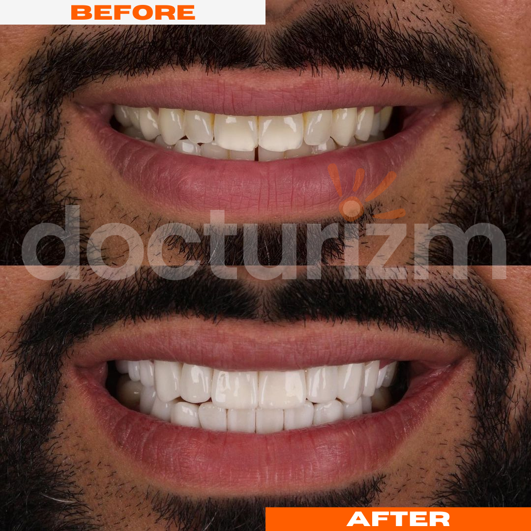 docturizm-beforeafter-4