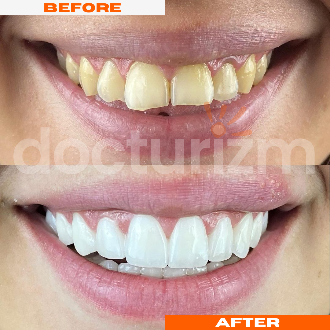 docturizm-beforeafter-5